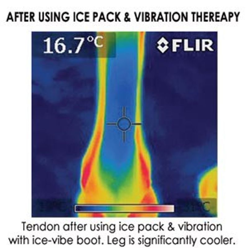 Ice-Vibe Knee Wrap